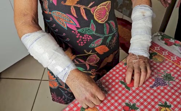 Idosa é atacada por dois pitbulls em Muriaé